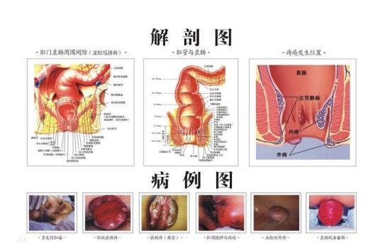 肛肠科