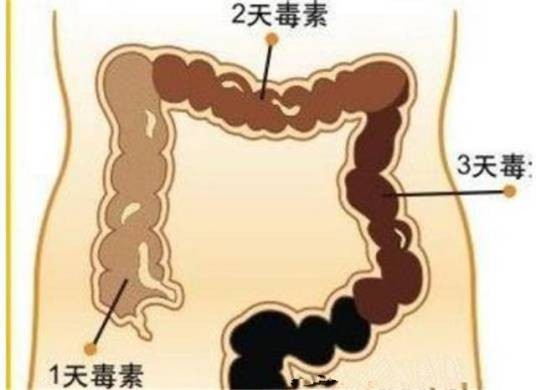 宿便