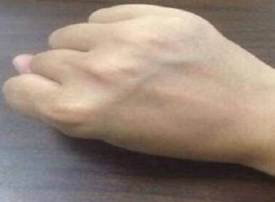 青筋
