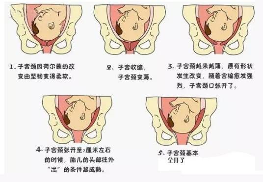 入盆