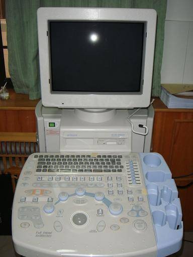 超声胃镜