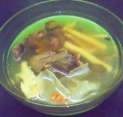 半夏白术天麻汤（中医方剂名）