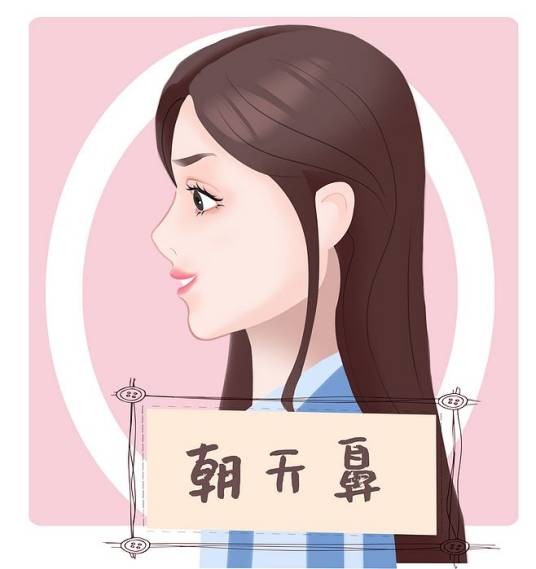 朝天鼻