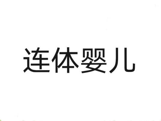 连体婴儿