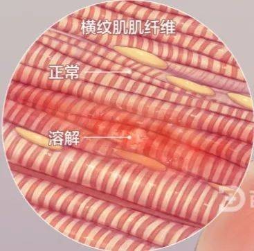 横纹肌