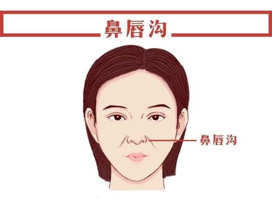 鼻唇沟