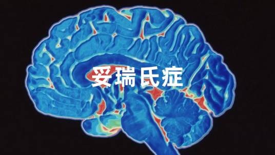 妥瑞氏症