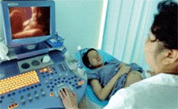 四维彩色超声诊断仪