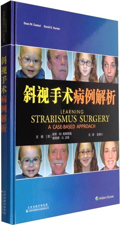 斜视手术病例解析