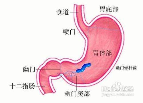 胃胀气