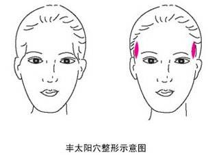 丰太阳穴