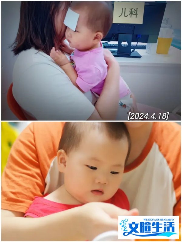 康复后的小葡萄江杺妹妹丨江先生1989