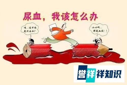 女子尿血1年取出20厘米蚯蚓状血丝——肾动静脉瘘