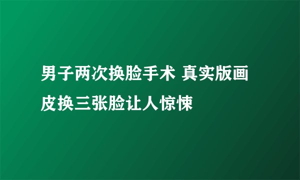 男子两次换脸手术 真实版画皮换三张脸让人惊悚