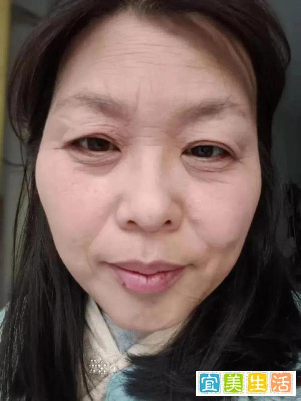 断崖式衰老女子本以为能漂亮过余生，和65岁妈妈一起，比她还显老