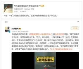 惊!两岁男童眼睛里捉出6条活虫