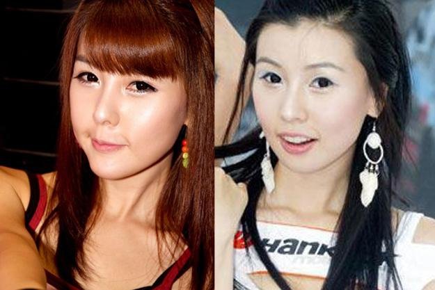 李智友整容前是什么样子？