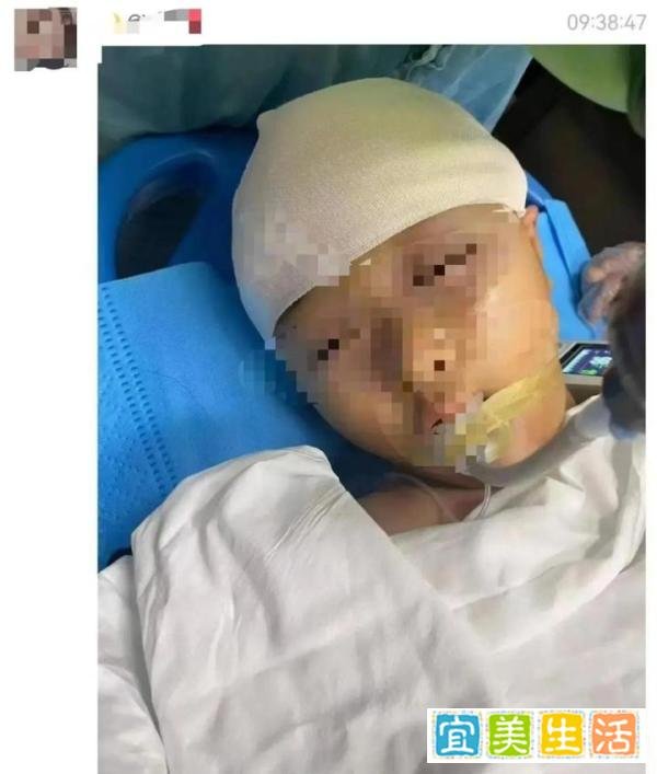 小学生被男教师打碎头骨？警方介入，教育局回应！