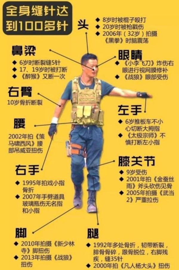 吴磊拍马戏时脸部被炸伤,坚持拍完戏再上医院就诊,粉丝心疼不已