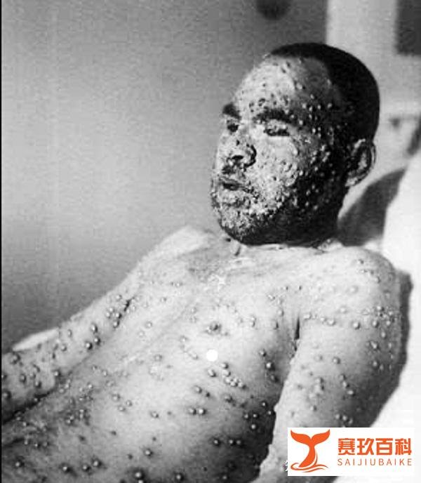 古代识人：麻面青须不可交，两腮无肉大弯腰