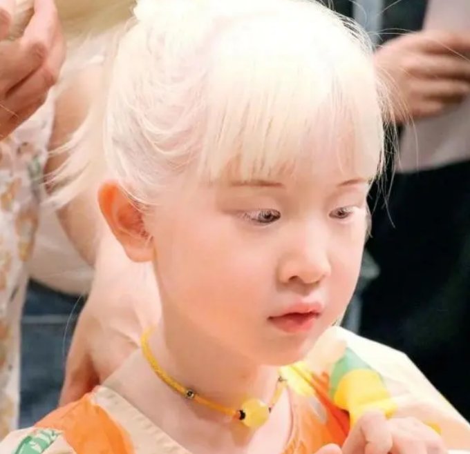 白化病女孩成幼儿园酷girl,为何在小孩们的眼中没有歧视?