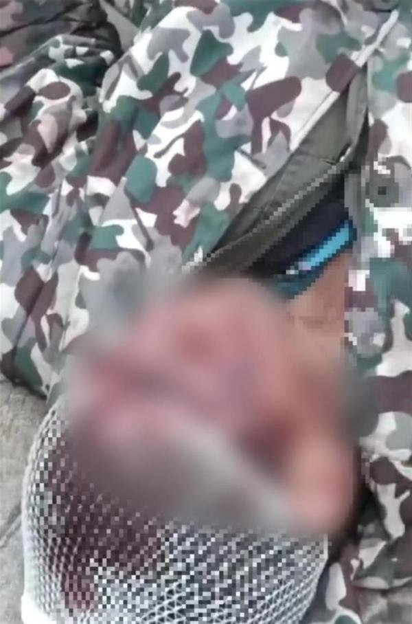 云南村民在山上挖笋发生冲突，多人受伤，为了笋值得吗？