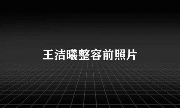 王洁曦整容前照片