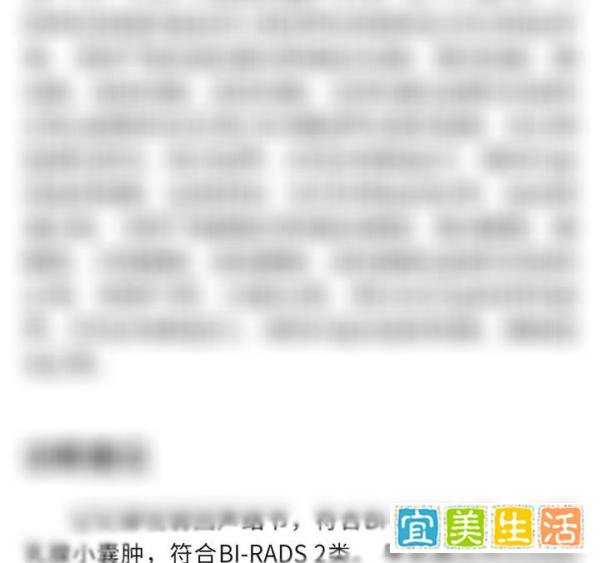 美国退出中导条约,不过是欺骗别人的拙劣表演，早有预谋