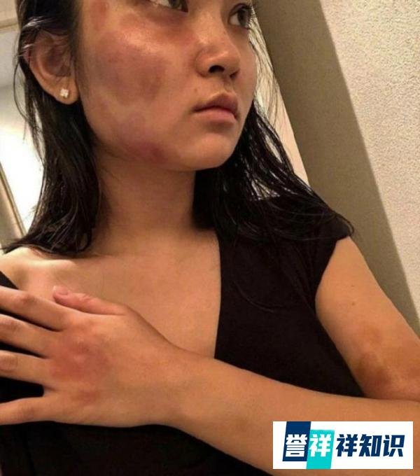 蒋劲夫家暴打女友真相曝光，女方口述以前7p过程激怒男方