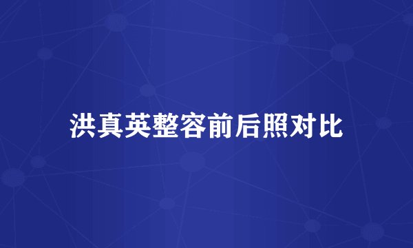 洪真英整容前后照对比