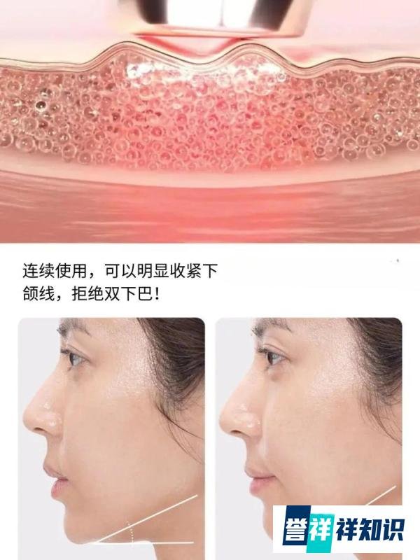 ??Medicube Age R Booster 美容仪测评