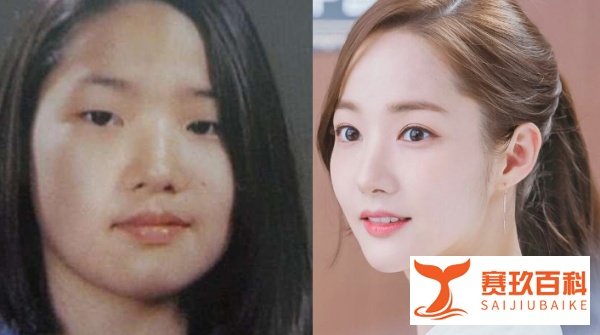 有一种变脸叫韩国整容：双门洞王子贤成王祖贤，她美成亚洲第一