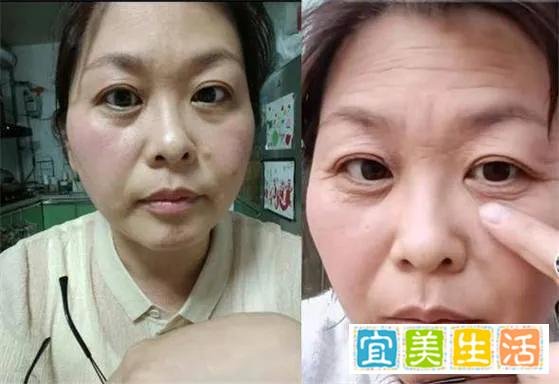 断崖式衰老女子本以为能漂亮过余生,和65岁妈妈一起,比她还显老