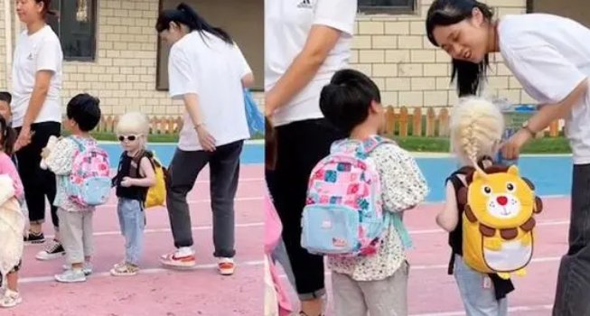 白化病女孩成幼儿园酷girl,为何在小孩们的眼中没有歧视?
