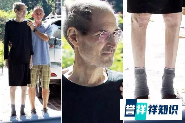 梅艳芳逝世20周年:她的癌症治疗经历有3点,至今仍值得警醒!