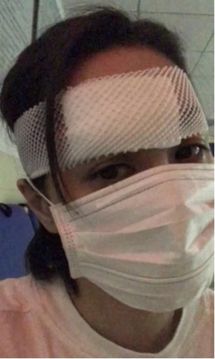 阿娇拆绷带后首露面拿手遮伤口,网友对此有何评价?