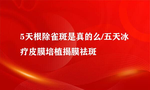 5天根除雀斑是真的么/五天冰疗皮膜培植揭膜祛斑