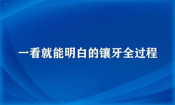 一看就能明白的镶牙全过程